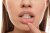 Aphtha and mouth care