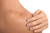 Scars, abrasions